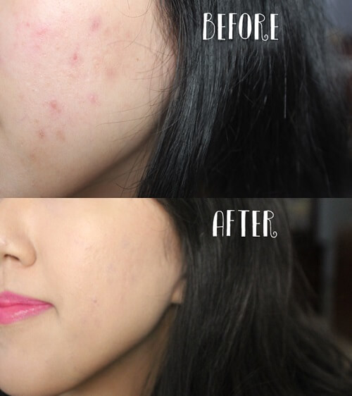 Dermacol Make Up Cover nhanh chóng giúp bạn sở hữu lớp da hoàn hảo, khỏe đẹp không tì vết