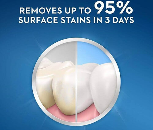 Kem đánh răng Crest 3D White nhanh chóng loại bỏ vết ố vàng, giúp răng trắng chỉ sau 3 ngày dùng