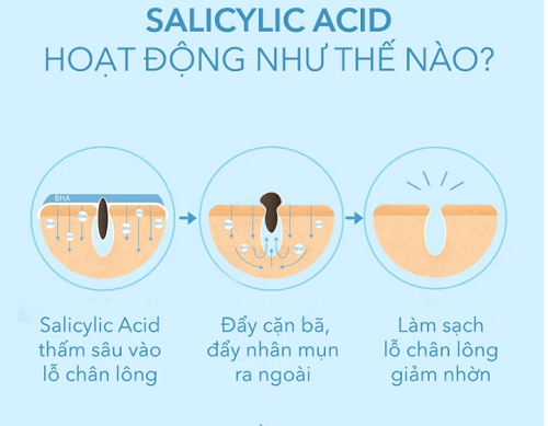 Sữa rửa mặt trị mụn Senka chứa hoạt chất Salicylic acid hàm lượng lớn đem lại hiệu quả trị mụn cực hiệu quả