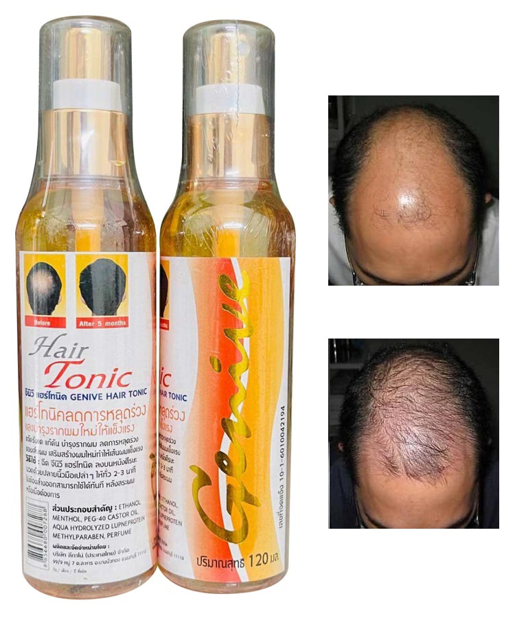 Tinh-Chat-Kich-Thich-Moc-Toc-Tri-Hoi-Dau-Hair-Tonic-Genive-Thai-Lan-4765.jpg